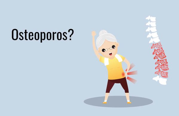 benskörhet osteoporos